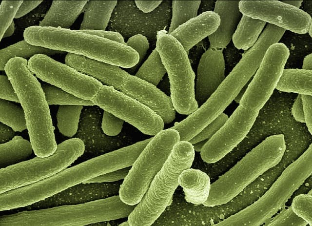 El objeto que acumula más bacterias en tu casa después de Navidad y casi nadie limpia