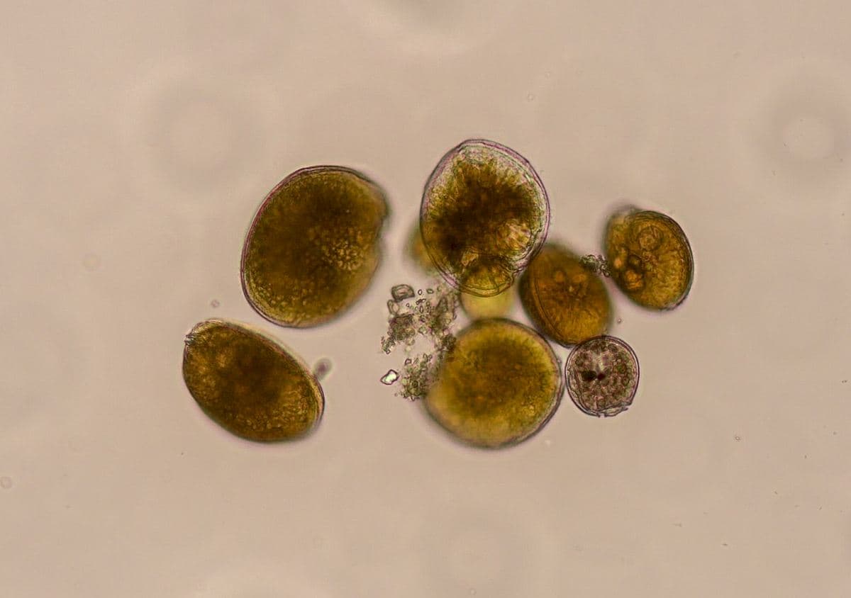 Detectan en España una microalga que puede provocar intoxicaciones graves por consumo de pescado